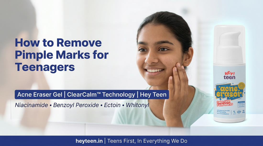 How to Remove Pimple Marks for Teenagers - The Real Answer