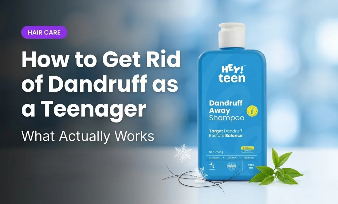 How to Get Rid of Dandruff as a Teenager — What Actually Works