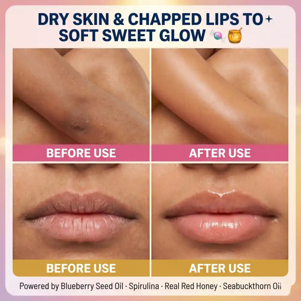 Before after dry skin and chapped lips to soft glowing skin – HEY! teen Soft & Sweet Set teen skincare