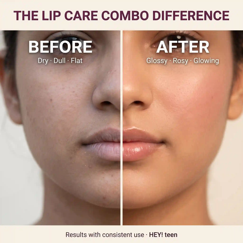 Rakhi Lip Care Combo (Blush Me Up + Honey Bee Balm)